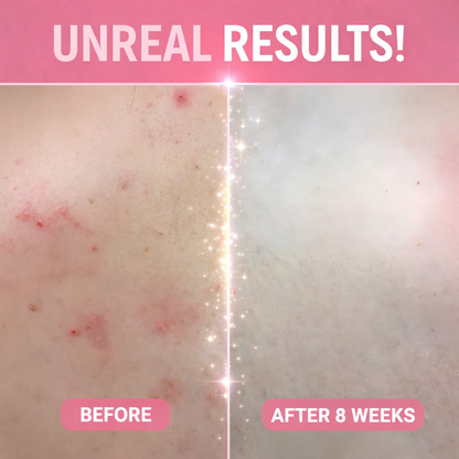 Karylona™ Bath Peeling SPA Exfoliating Glove